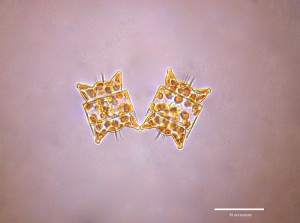 Odontella aurita cells